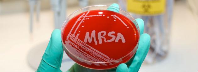 MRSA-frygt isolerer flygtninge på hospitaler