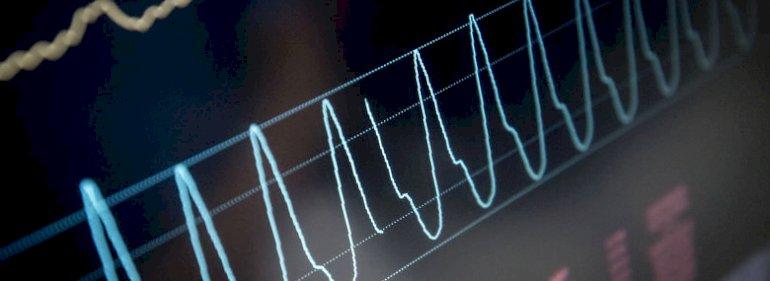 Nordjyder er dukse i at udrede hjertepatienter til tiden